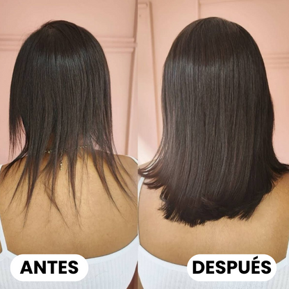 Remimpi Anti-Caída